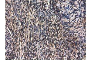 Immunohistochemical staining of paraffin-embedded Human liver tissue using anti-QPRT mouse monoclonal antibody. (QPRT 抗体)