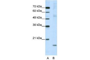 WB Suggested Anti-NIP7 Antibody Titration:  5. (NIP7 抗体  (C-Term))