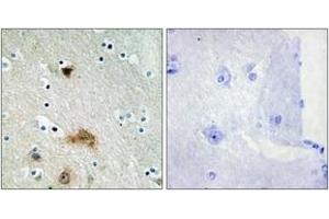 Immunohistochemistry analysis of paraffin-embedded human brain tissue, using LASS4 Antibody. (LASS4 抗体  (AA 41-90))