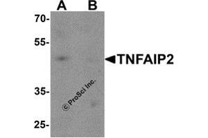 Western Blotting (WB) image for anti-Tumor Necrosis Factor, alpha-Induced Protein 2 (TNFAIP2) antibody (ABIN1077380) (TNFAIP2 抗体)