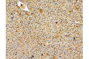 ABIN7096070 and ABIN7100132 at 1/100 staining mouse liver tissue by IHC-P.