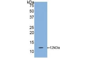 Western blot analysis of recombinant Human IL1R1. (IL1R1 抗体  (AA 120-208))