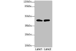 Western blot All lanes: NMUR1 antibody at 2 μg/mL Lane 1: Mouse liver tissue Lane 2: Mouse kidney tissue Secondary Goat polyclonal to rabbit IgG at 1/10000 dilution Predicted band size: 47 kDa Observed band size: 47 kDa (NMUR1 抗体  (AA 360-426))