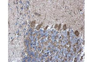 IHC-P Image RPL5 antibody detects RPL5 protein at cytoplasm on mouse hind brain by immunohistochemical analysis. (RPL5 抗体)