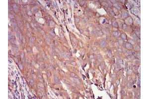 Immunohistochemistry (IHC) image for anti-serpin Peptidase Inhibitor, Clade A (Alpha-1 Antiproteinase, Antitrypsin), Member 1 (SERPINA1) (AA 23-237) antibody (ABIN5542585)