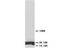 Western blot analysis of rat tissue sections (kidney) lysis using AQP1 antibody (Aquaporin 1 抗体  (C-Term))