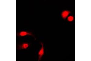 Immunofluorescent analysis of NF-kappaB p105 (pS927) staining in HeLa cells. (NFKB1 抗体  (C-Term, pSer927))