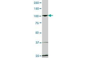 EVI5L MaxPab polyclonal antibody. (EVI5L 抗体  (AA 1-794))