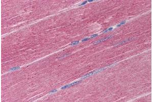 Human Skeletal Muscle (formalin-fixed, paraffin-embedded) stained with ADAM17 antibody ABIN290260 at 20 ug/ml followed by biotinylated goat anti-rabbit IgG secondary antibody ABIN481713, alkaline phosphatase-streptavidin and chromogen. (ADAM17 抗体  (C-Term))