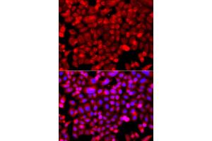 Immunofluorescence analysis of A549 cells using NDUFV1 antibody (ABIN5974962). (NDUFV1 抗体)