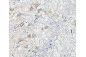 Immunohistochemistry of paraffin-embedded Rat brain using CHIC2 Polyclonal Antibody at dilution of 1:100 (40x lens). (CHIC2 抗体)