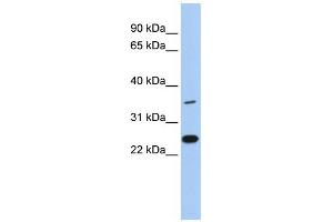 WB Suggested Anti-LYVE1 Antibody Titration: 0.