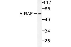 Image no. 1 for anti-V-Raf Murine Sarcoma 3611 Viral Oncogene Homolog (ARAF) antibody (ABIN271994)