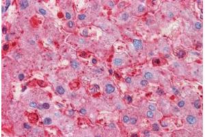 Immunohistochemistry (Formalin-fixed Paraffin-embedded Sections) (IHC (fp)) image for anti-Ring Finger Protein 144B (RNF144B) (AA 1-101) antibody (ABIN574475)