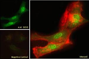 ABIN6391384 Immunofluorescence analysis of paraformaldehyde fixed U251 cells, permeabilized with 0. (SOX2 抗体  (N-Term))