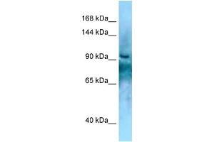 WB Suggested Anti-KANK2 Antibody Titration: 1. (KANK2 抗体  (C-Term))