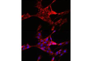 Immunofluorescence analysis of PC-12 cells using TXNIP antibody (ABIN6130776, ABIN6149733, ABIN6149734 and ABIN6224986) at dilution of 1:100. (TXNIP 抗体  (AA 1-166))