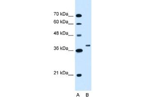 WB Suggested Anti-RNF146 Antibody Titration:  1. (RNF146 抗体  (C-Term))