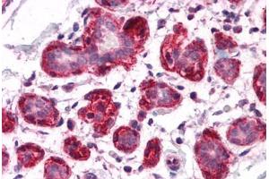 Human Breast: Formalin-Fixed, Paraffin-Embedded (FFPE) (SH3BP4 抗体  (C-Term))