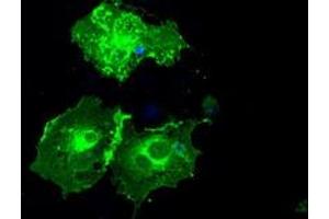 Image no. 4 for anti-Fc gamma RII (CD32) antibody (ABIN1497254) (Fc gamma RII (CD32) 抗体)