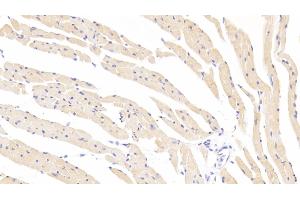 Detection of SOD3 in Mouse Cardiac Muscle Tissue using Polyclonal Antibody to Superoxide Dismutase 3, Extracellular (SOD3) (SOD3 抗体  (AA 25-251))