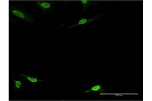 Immunofluorescence of monoclonal antibody to PBK on HeLa cell. (PBK 抗体  (AA 122-229))