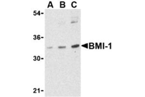 Image no. 1 for anti-BMI1 Polycomb Ring Finger Oncogene (BMI1) (Middle Region) antibody (ABIN318769)