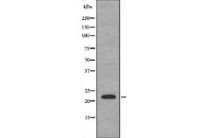 Western blot analysis of extracts from HeLa using CRP1 antibody. (CSRP1 抗体  (Internal Region))