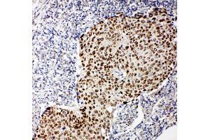 Anti-p63 antibody, IHC(P) IHC(P): Human Lung Cancer Tissue (p63 抗体  (C-Term))