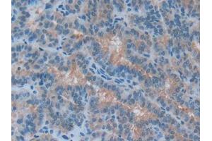 Used in DAB staining on fromalin fixed paraffin- embedded liver tissue (Acetylcholinesterase 抗体  (AA 366-554))