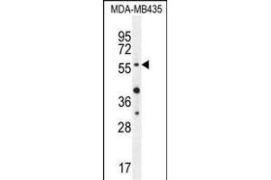 AKT1 (Thr308) Antibody (ABIN654500 and ABIN2844231) western blot analysis in MDA-M cell line lysates (35 μg/lane). (AKT1 抗体  (Thr308))