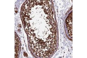 Immunohistochemical staining of human testis with LSM7 polyclonal antibody  shows strong cytoplasmic positivity in cells in seminiferus duct. (LSM7 抗体)