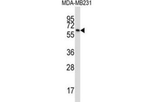 Western Blotting (WB) image for anti-Butyrophilin, Subfamily 3, Member A1 (BTN3A1) antibody (ABIN2997361) (BTN3A1 抗体)