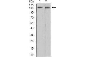 Western blot analysis using RAD50 mouse mAb against C6 (1) and HepG2 (2) cell lysate. (RAD50 抗体  (AA 228-359))