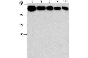 Western Blot analysis of A431, K562, 231, hela and hepG2 cell using HK2 Polyclonal Antibody at dilution of 1:1200 (Hexokinase 2 抗体)