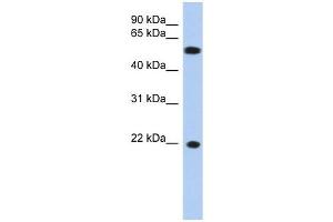 Crystallin Gamma C antibody used at 1 ug/ml to detect target protein.