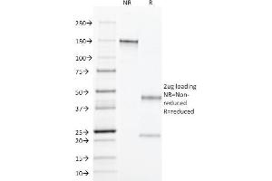 SDS-PAGE Analysis Purified TGF alpha Mouse Monoclonal Antibody (MF9). (TGFA 抗体  (C-Term))