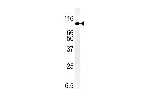 Western Blotting (WB) image for anti-SMAD Specific E3 Ubiquitin Protein Ligase 1 (SMURF1) (AA 66-96), (N-Term) antibody (ABIN388828)