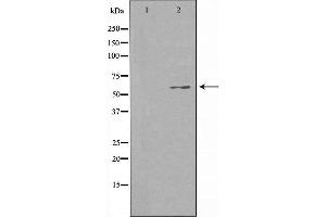 Western blot analysis of extracts from HuvEc cells using CCDC102B antibody. (CCDC102B 抗体  (Internal Region))