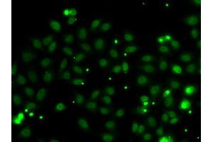 Immunofluorescence analysis of MCF-7 cells using NGFRAP1 antibody (ABIN5974398). (Nerve Growth Factor Receptor (TNFRSF16) Associated Protein 1 (NGFRAP1) 抗体)