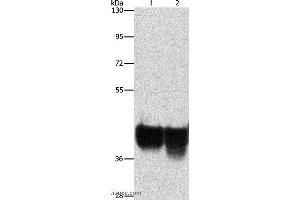 Western blot analysis of Hela and 293T cell, using AUP1 Polyclonal Antibody at dilution of 1:500 (Ancient Ubiquitous Protein 1 抗体)