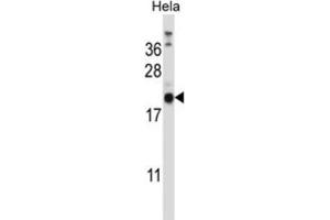 Western Blotting (WB) image for anti-Proline Rich Gla (G-Carboxyglutamic Acid) 1 (PRRG1) antibody (ABIN2997291) (PRRG1 抗体)