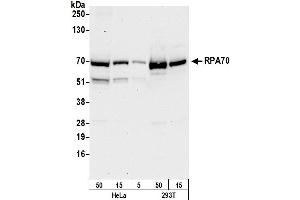 Western Blotting (WB) image for anti-Replication Protein A1, 70kDa (RPA1) (AA 350-400) antibody (ABIN7453556)