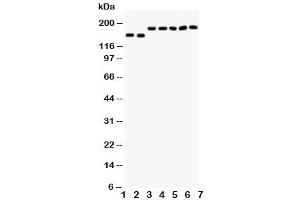 Western Blotting (WB) image for anti-Deleted in Colorectal Carcinoma (DCC) (AA 162-178) antibody (ABIN3030709)