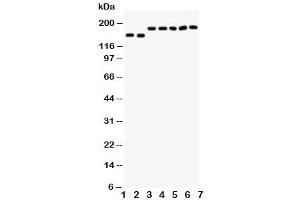 Western blot testing of DCC antibody and Lane 1:  rat brain (DCC 抗体  (AA 162-178))