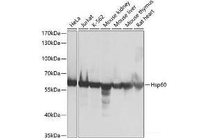 Western blot analysis of extracts of various cell lines using Hsp60 Polyclonal Antibody at dilution of 1:1000. (HSPD1 抗体)