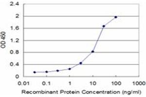 Detection limit for recombinant GST tagged STK17A is approximately 1ng/ml as a capture antibody. (STK17A 抗体  (AA 301-413))