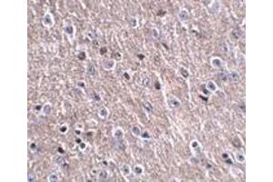 Immunohistochemistry (IHC) image for anti-LITAF-Like Protein (CDIP1) (Middle Region 1) antibody (ABIN1031187) (CDIP1 抗体  (Middle Region 1))