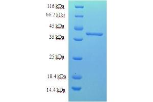 SDS-PAGE (SDS) image for Chromosome 18 Open Reading Frame 10 (C18orf10) (AA 20-359) protein (His tag) (ABIN5712722)