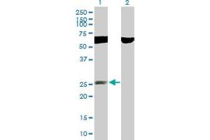 Western Blot analysis of RNF141 expression in transfected 293T cell line by RNF141 MaxPab polyclonal antibody. (RNF141 抗体  (AA 1-230))